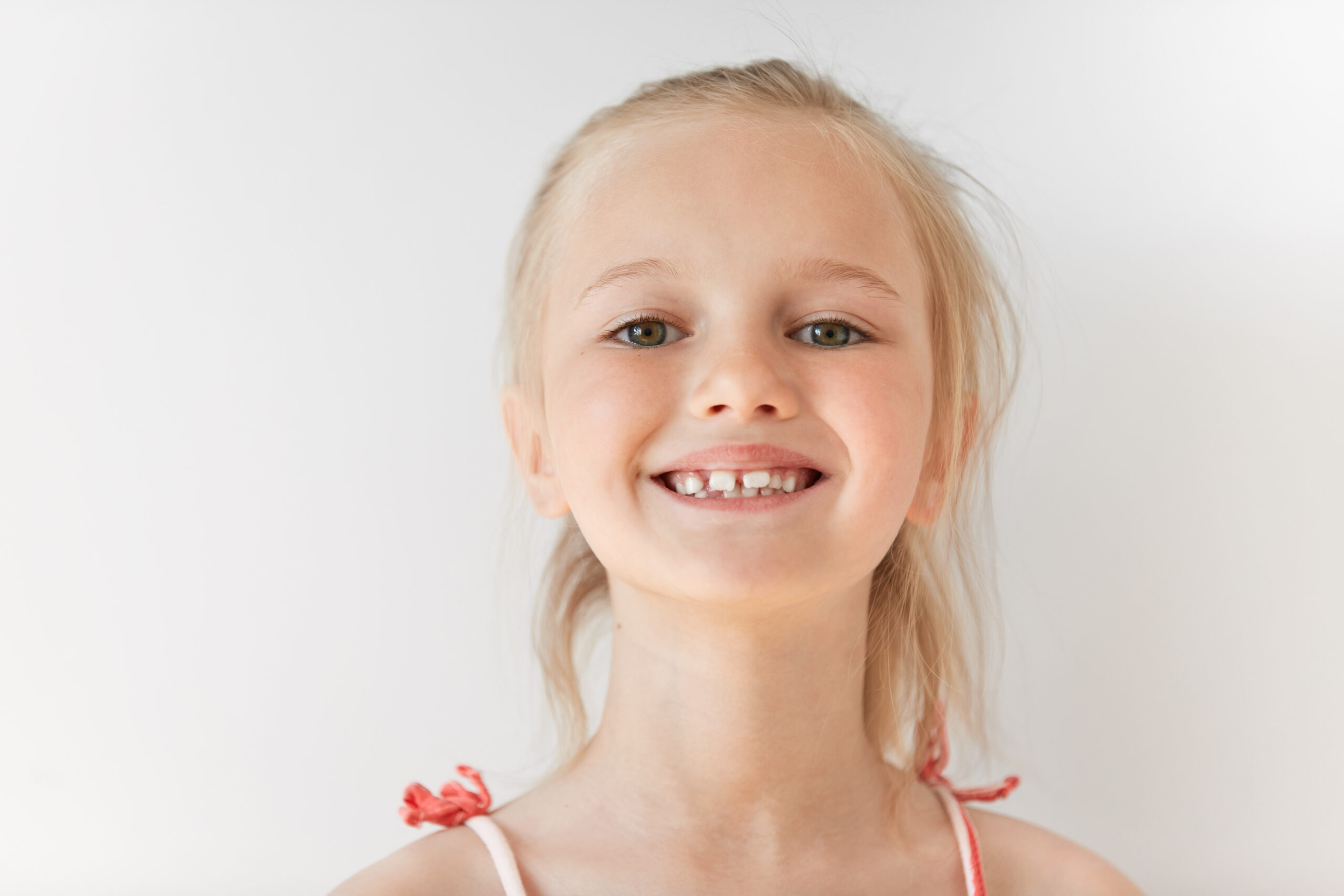 Invisalign First: алайнери за деца – какво могат и какво не